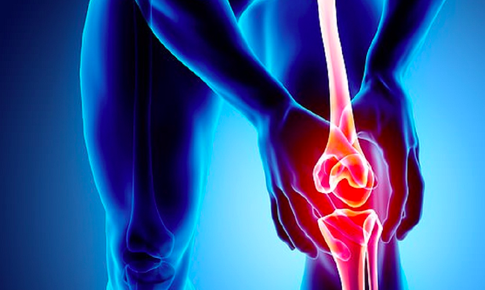 Thoái hóa khớp gối nên làm gì?