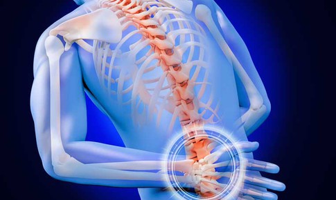 3 bí quyết phòng ngừa viêm cột sống dính khớp