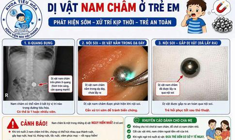 Gắp thành công viên bi nam châm trong dạ dày trẻ hơn 3 tuổi