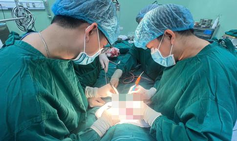 Bóc tách khối u quái nặng 1/3 trọng lượng cơ thể cho bé 4 tháng tuổi
