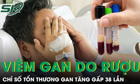 Uống rượu nhiều năm, người đàn ông có chỉ số tổn thương gan tăng gấp 38 lần