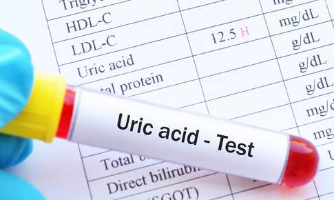 Tăng acid uric có làm suy giảm ‘bản lĩnh’ nam giới?