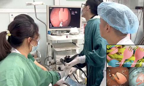 Cắn gãy thìa nhựa khi ăn sữa chua, bé 20 tháng tuổi phải nhập viện cấp cứu