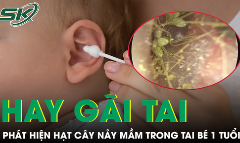 Bé trai liên tục gãi tai, bác sĩ phát hiện hạt cây đã nảy mầm bên trong