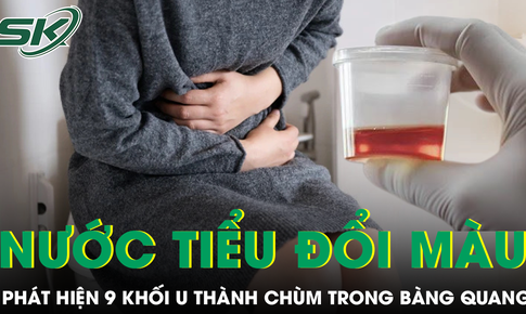 Nước tiểu chuyển màu, phát hiện 9 khối u thành chùm trong bàng quang