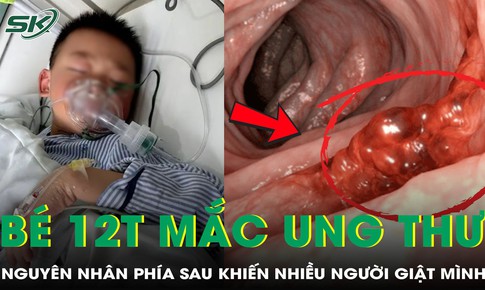 Bé trai 12 tuổi mắc ung thư dạ dày, nguyên nhân khiến ai cũng giật mình
