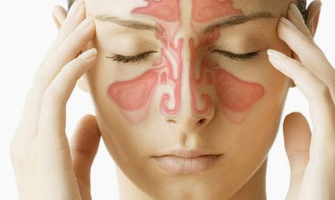 5 yếu tố làm tăng nguy cơ viêm xoang