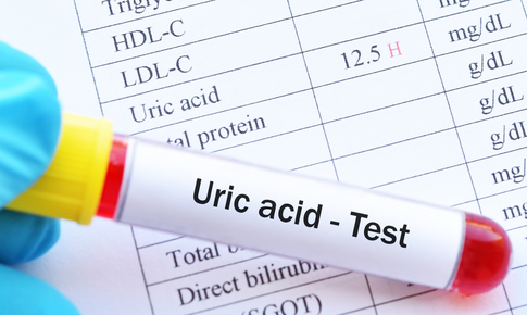 7 lưu ý khi tầm soát acid uric