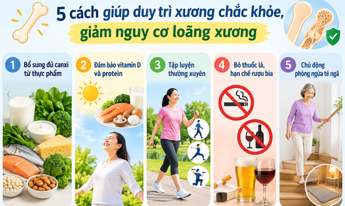 5 cách giúp duy trì xương chắc khỏe, giảm loãng xương