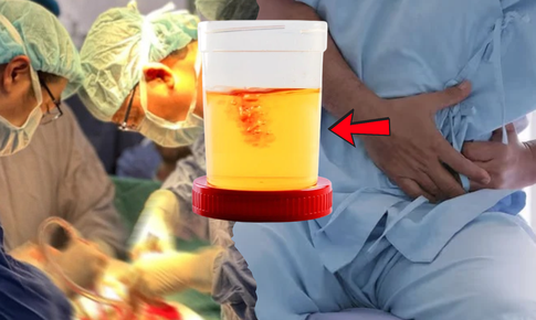 Người đàn ông phải cắt bỏ bàng quang vì một dấu hiệu bị bỏ qua quá lâu
