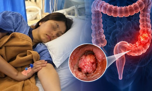 Nữ sinh mới 15 tuổi đã qua đời vì ung thư đại trực tràng giai đoạn cuối