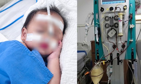 Từ cơn sốt thông thường, bé 2 tuổi hôn mê gan suýt chết