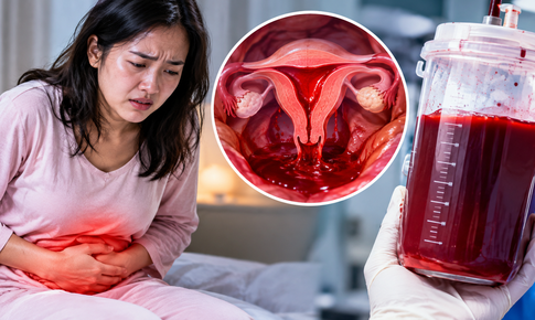Chậm kinh 10 ngày, người phụ nữ 31 tuổi chảy hơn 600 ml máu trong ổ bụng