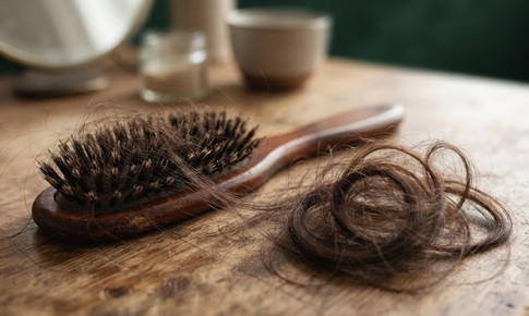 Rụng tóc hơn 100 sợi mỗi ngày có đáng lo?