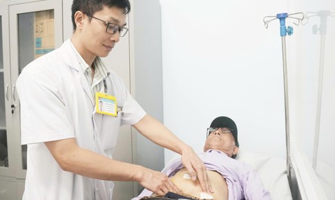Đau bụng âm ỉ, cụ ông 82 tuổi phát hiện u nhầy ruột thừa hiếm gặp