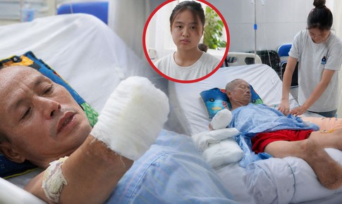 Câu nói xé lòng của người cha đơn thân bị điện giật phải cắt cụt tay chân