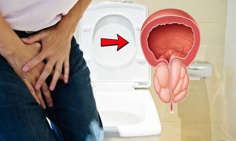 Tiểu khó suốt 10 năm, người đàn ông phát hiện tuyến tiền liệt lớn bất thường