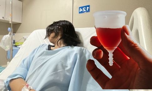 Cô gái 30 tuổi nhiễm trùng thận vì thứ 'đồ nữ giới' quen thuộc dùng hàng tháng