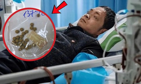 Người đàn ông suy gan vì tự uống thuốc chữa xơ gan, vàng da gấp 42 lần