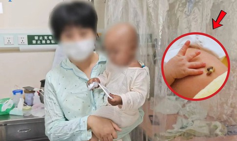 Bé trai 1 tuổi mắc bệnh máu hiếm, người mẹ cứu con thoát chết nhờ việc này