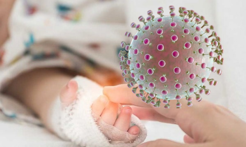 Bé trai sốt 2 ngày, 6 ngày sau phải mở sọ cấp cứu