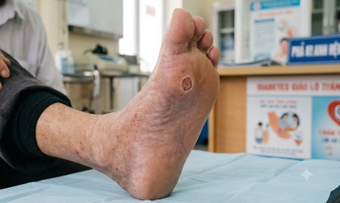 5 nhóm người không nên ngâm chân