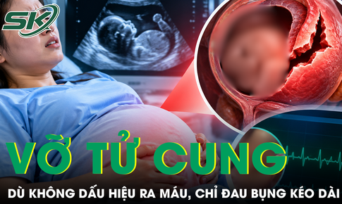 Thai phụ 36 tuần vỡ tử cung dù không ra máu, tim thai vẫn bình thường