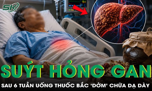 Người đàn ông 61 tuổi suýt hỏng gan sau 6 tuần uống thuốc bắc 'dởm'