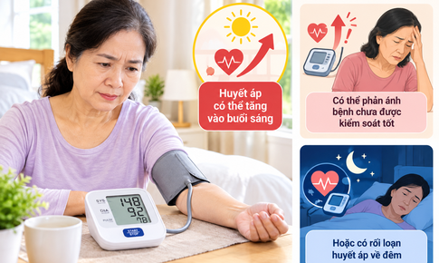Huyết áp cao buổi sáng, làm gì để kiểm soát mà không dùng thuốc?