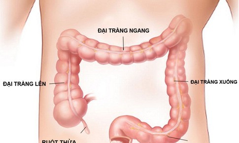 Giải đ&#225;p c&#225;c thắc mắc h&#224;ng ng&#224;y về Vi&#234;m đại tr&#224;ng