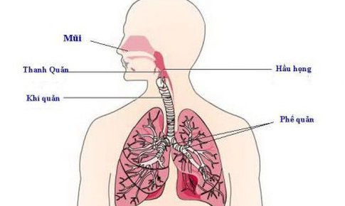 Ph&#242;ng vi&#234;m phế quản cấp như thế n&#224;o?