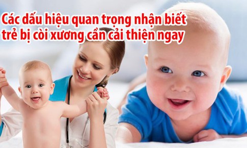 Nhận biết v&#224; ph&#242;ng c&#242;i xương dinh dưỡng