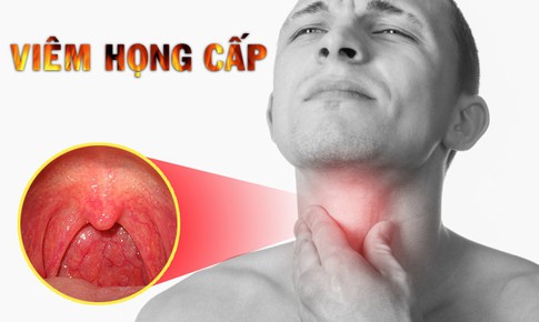 Vi&#234;m họng c&#226;́p và cách phòng ch&#244;́ng