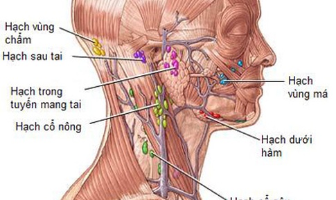 Hạch sưng, đau c&#243; phải trọng bệnh?