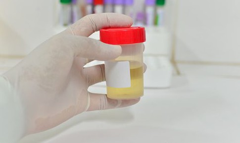 4 dấu hiệu mách bạn có vấn đề bàng quang