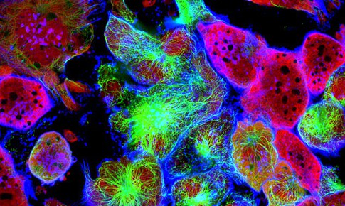 Tạo ra virus mới có thể tiêu diệt mọi loại tế bào ung thư trong tương lai