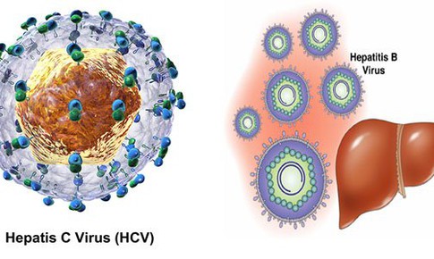 L&#224;m thế n&#224;o để ngừa l&#226;y nhiễm vi&#234;m gan C?