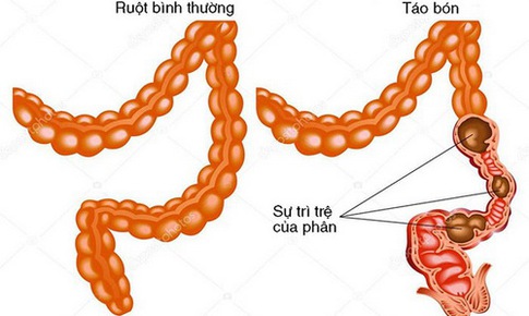 Thuốc chữa bệnh ti&#234;u h&#243;a g&#226;y hại... đường ti&#234;u h&#243;a