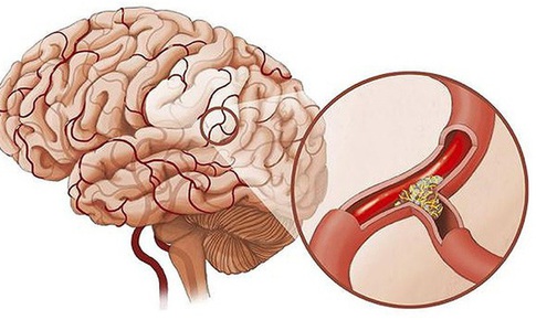 Ph&#242;ng ngừa thiếu m&#225;u n&#227;o