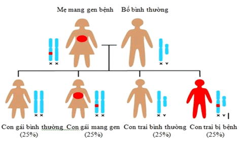 Hiểu về bệnh Hemophilia để tr&#225;nh mang th&#234;m những nỗi đau