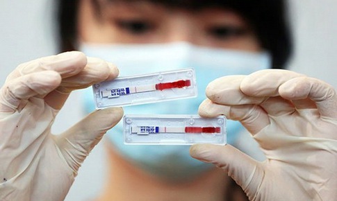 Xét nghiệm mới chẩn đoán nhiễm trùng lây qua đường tình dục