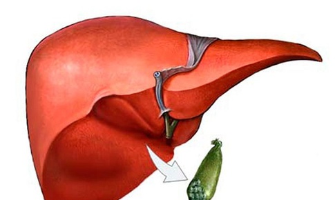 Cắt t&#250;i mật g&#226;y ảnh hưởng g&#236;?