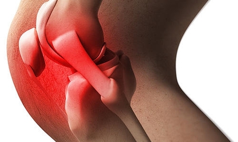 Đầu gối kêu răng rắc ở trẻ em có đáng lo?