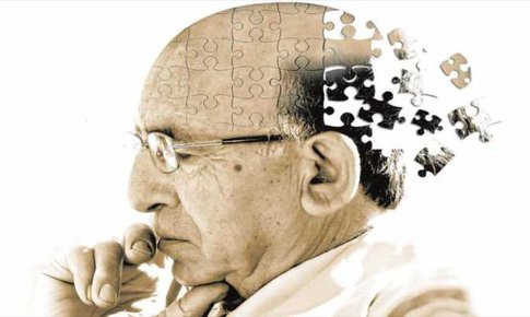 Bệnh Alzheimer c&#243; phải do di truyền?