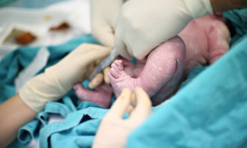Sinh thường v&#224; những lợi &#237;ch
