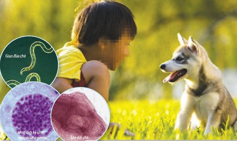 Dễ mắc k&#253; sinh tr&#249;ng từ th&#250; cưng