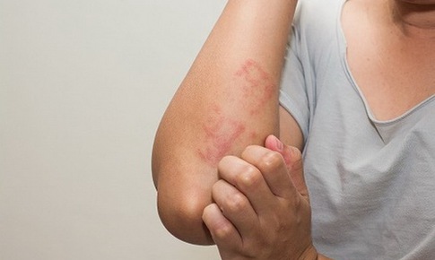 Các xu hướng sức khỏe đáng báo động