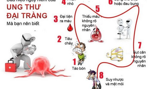 Cảnh gi&#225;c với ung thư đại trực tr&#224;ng