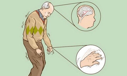 Khắc phục bất lợi khi d&#249;ng levodopa trị Parkinson