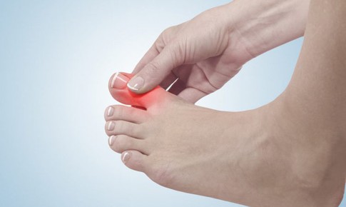 Làm sao biết mình mắc gút?